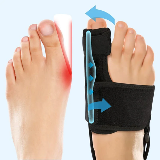 Valgux™ Brace: Den Smärtfria Lösningen för Hallux Valgus – Utan Operation!