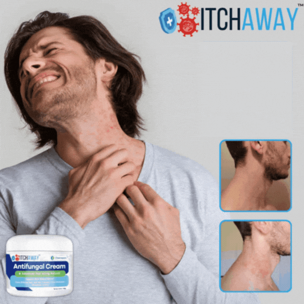 ItchAway™ Anti-Eksem-Crème | Snabb lindring vid eksem och psoriasis