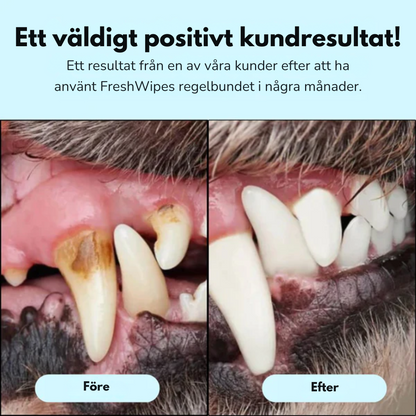 FreshWipes Kit – Skyddar mot problem med tänderna