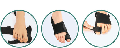Valgux™ Brace: Den Smärtfria Lösningen för Hallux Valgus – Utan Operation!