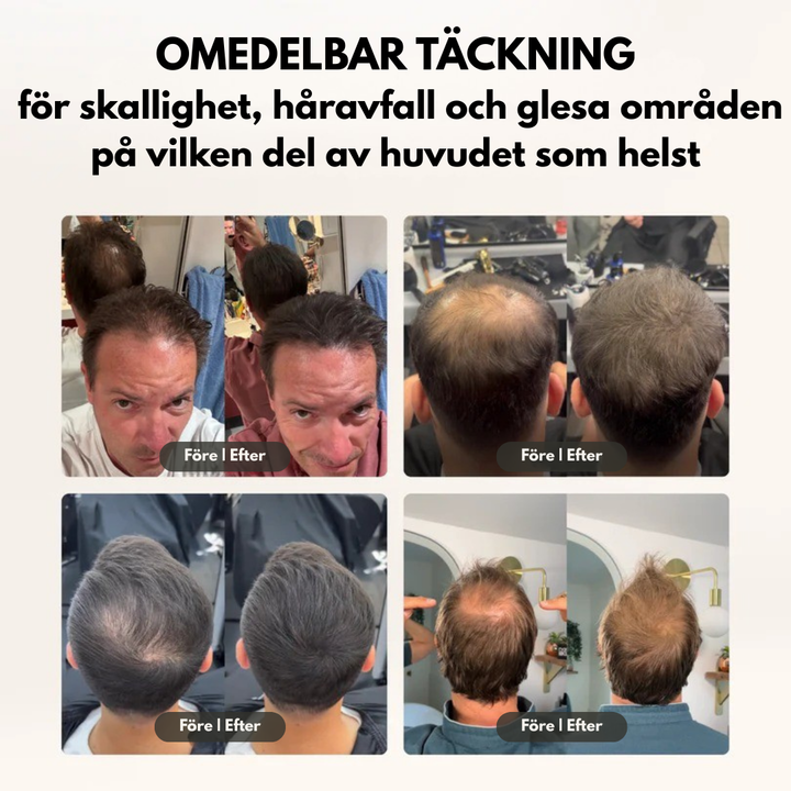Namilka™ – Naturlig Lösning mot Håravfall